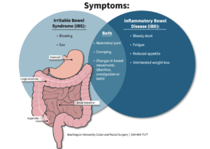 Read more about the article Inflammatory Bowel Disease