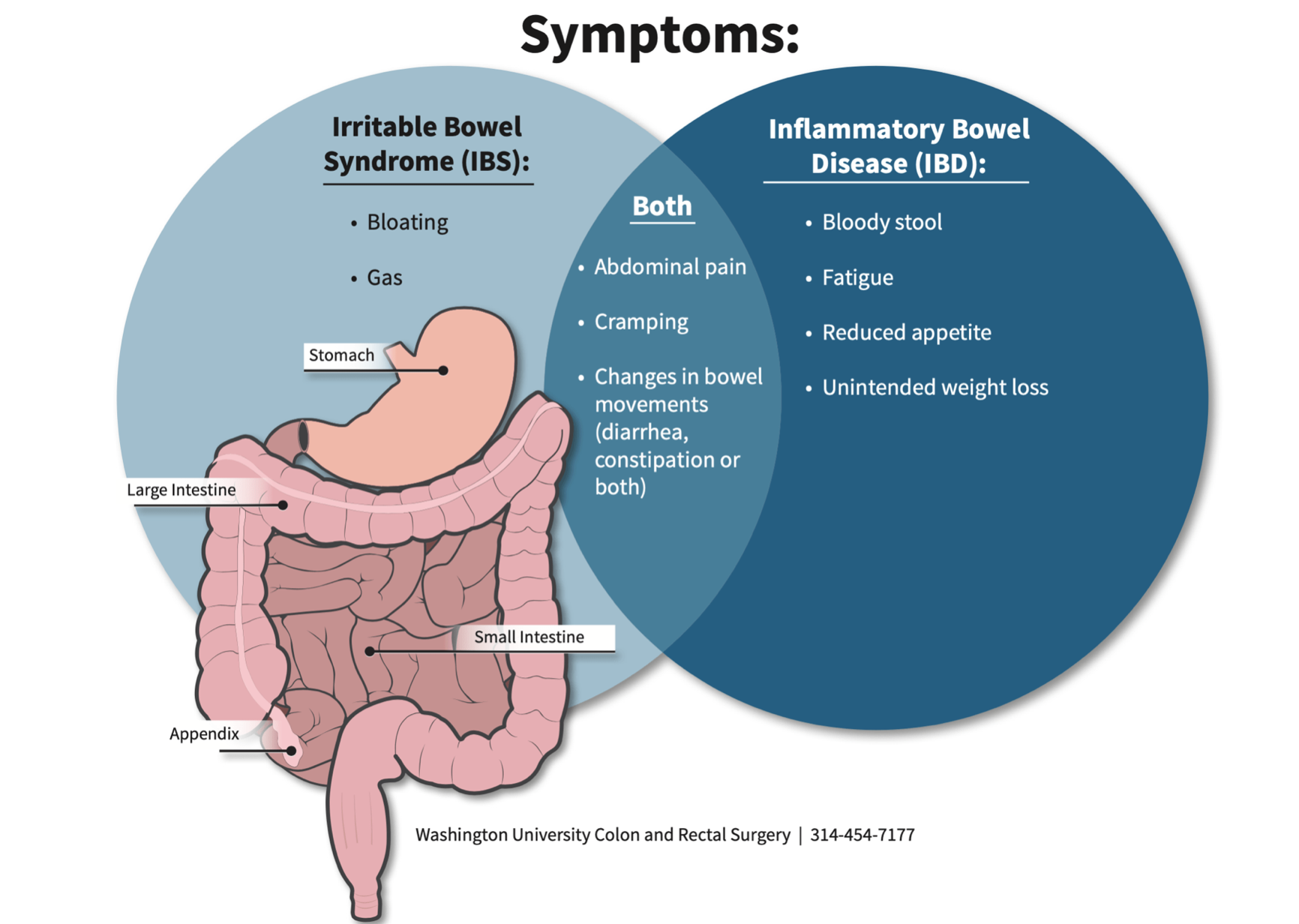 You are currently viewing Inflammatory Bowel Disease